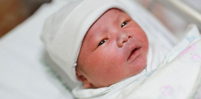 Mata Merah Berdarah/ Subconjunctival Hemorrhage Pada Bayi, Kenali Punca & Cara Rawatannya