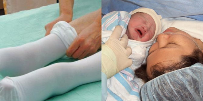 Ted Stokin Disaran Doktor Untuk Ibu Berpantang Caesar, Berkesan Elak Risiko Darah Beku