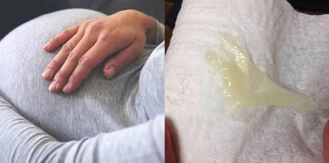 Mucus Plug Keluar Tanda Nak Bersalin, Ibu Pastikan 'Alert' Dengan Ciri Mucus Plug Ya!