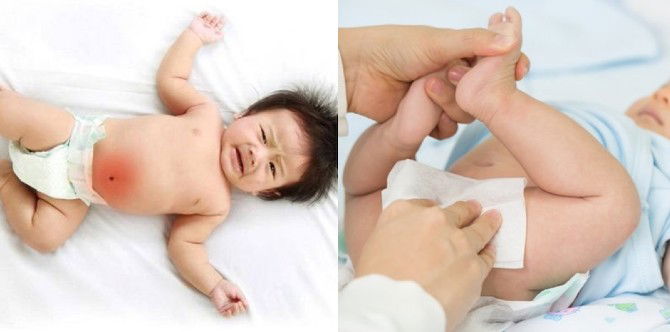 Bayi Tak Berak, Adakah Bahaya? Ibu Ayah, Fahami Tentang Kesihatan Usus Bayi Yang Normal