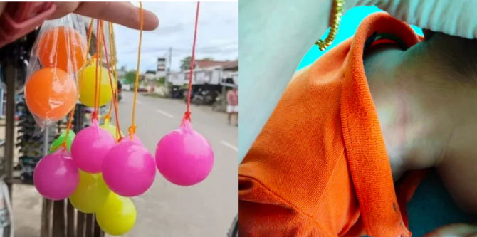 Anak Tiba-Tiba Diam & Tiada Suara, Ibu Berteriak Mainan Viral Terbelit Pada Leher