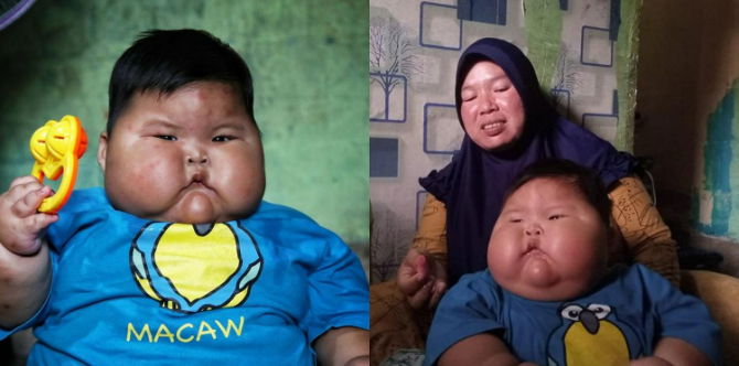 Berat Cecah 27kg Pada Usia 16 Bulan, Bayi Obesiti Selepas Ibu Beri Minum Susu Pekat