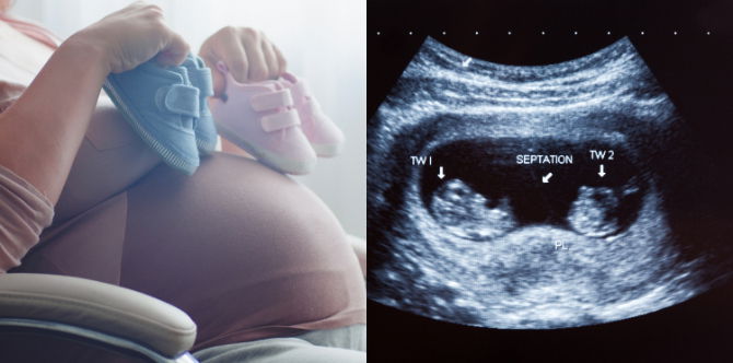 Pengalaman Hamil Anak Kembar, Pakar Kongsikan 7 Perkara Penting Ibu Kena Take Note