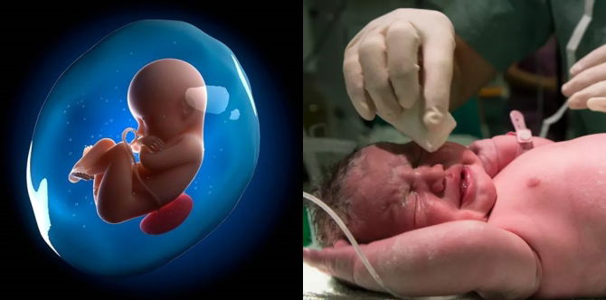 Pecah Air Ketuban Boleh Terjadi Bila-bila Masa Sahaja. Ibu Siap Sedia Ya!