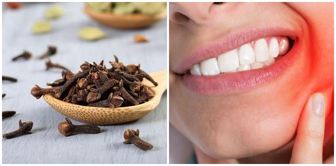Cara Hilangkan Sakit Gigi Dengan Bahan Di Rumah Ikut Petua Orang Dulu-Dulu