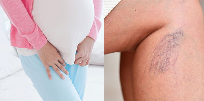 7 Perubahan Pelik Ketika Hamil Yang Mungkin Anda Tak Tahu, Tapi Sebenarnya Ia NORMAL