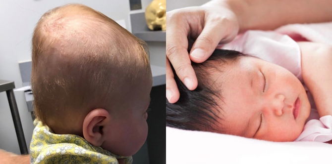 Bantal Tidur Yang Betul Untuk Bayi Baru Lahir Itu Penting Untuk Cegah Sindrom Flat Head