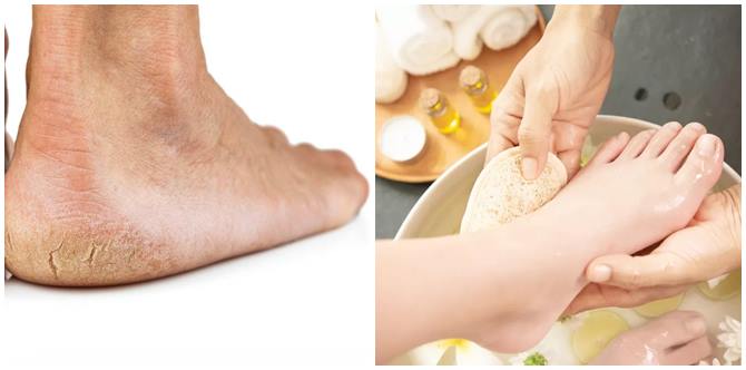 Malas Cuci Kaki? Ini Yang Berlaku Kalau Anda Tak Cuci Kaki Dengan Betul!