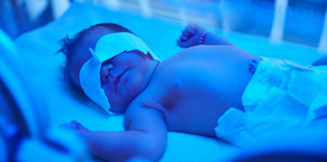 Sesi Tanya Pakar: Pengambilan Susu Kambing Untuk Bayi Kuning/ Jaundice, Adakah Berkesan?