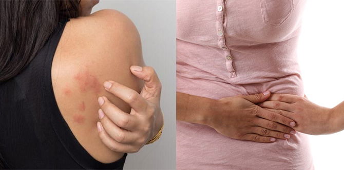 Tanda-Tanda HIV Pada Wanita, Anda Mungkin Rasa Sakit Semasa Melakukan Hubungan Seks