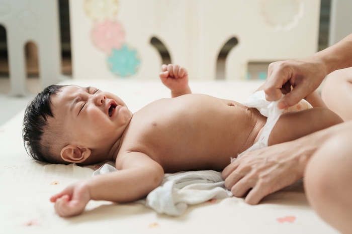 Pentingnya Lampin Bayi Terbaik Yang Diluluskan Pakar Pediatrik Demi Menjaga Kulit Bayi Yang Sensitif