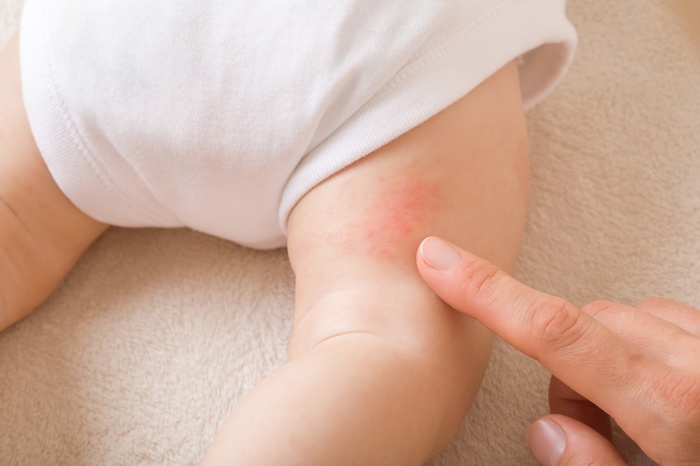 Pentingnya Lampin Bayi Terbaik Yang Diluluskan Pakar Pediatrik Demi Menjaga Kulit Bayi Yang Sensitif