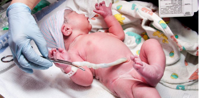 Apa Itu Darah Tali Pusat (Cord Blood Banking), Manfaat Untuk Kesihatan & Proses Penyimpanan