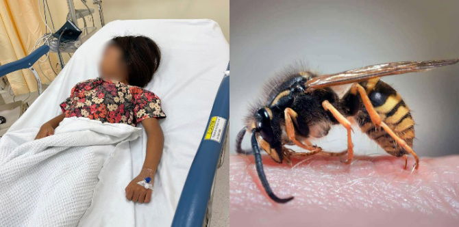 Budak 6 Tahun Meninggal Disengat 40 Ekor Tebuan Ketika Bermain, Doktor Jelaskan Bahaya Sengatan Boleh Membawa Maut