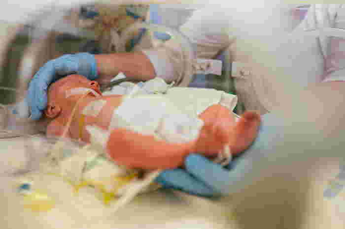Alami Kehamilan Berisiko? Ketahui Bagaimana Pakar Neonatologi Boleh Bantu Anda