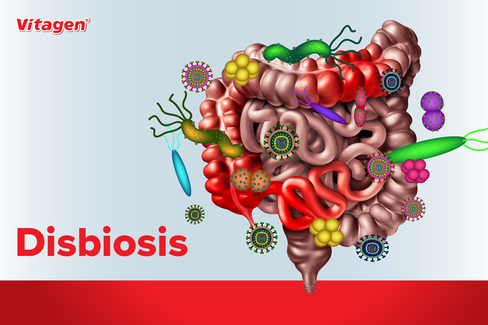 Nak Badan Sihat dan Kesejahteraan Mental? Segalanya Bermula dengan Usus Yang Sihat!